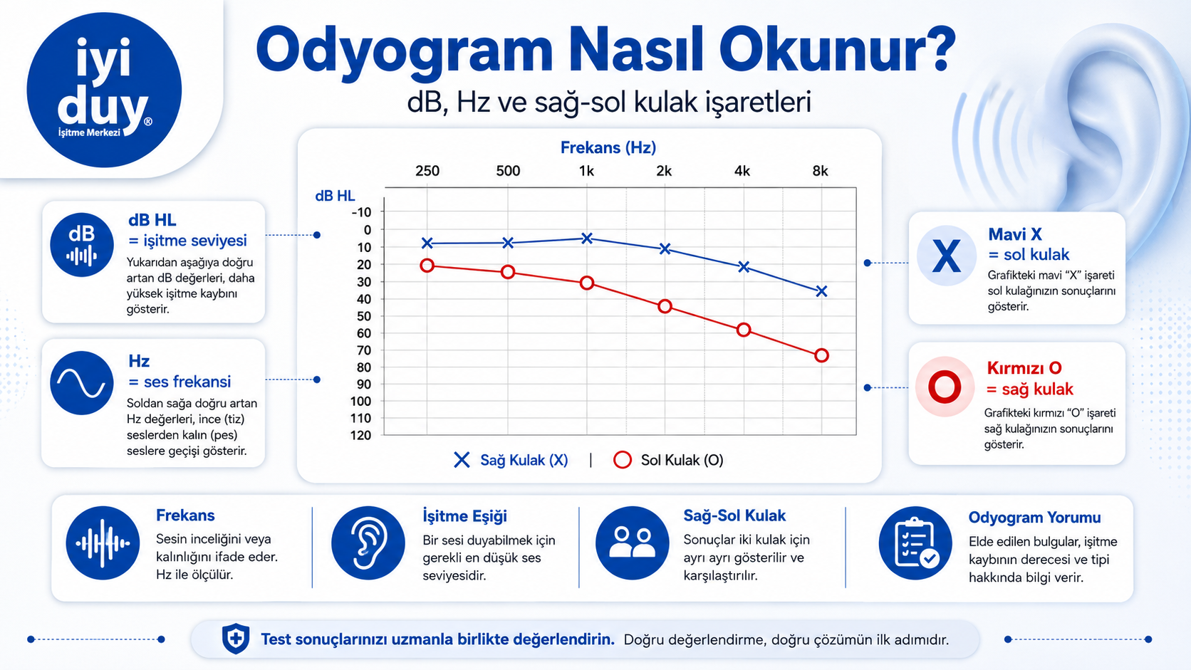 Odyogram nasıl okunur